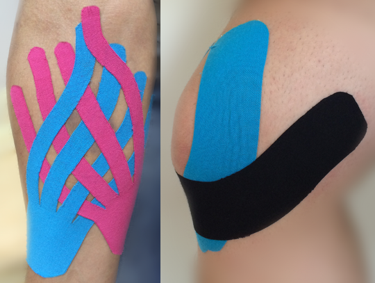 Kinesiotaping a ciąża