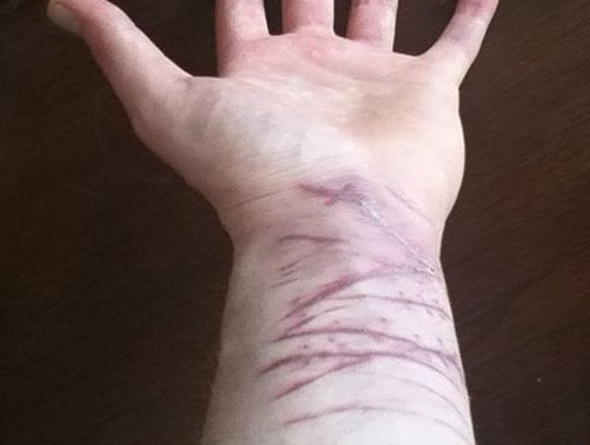 LEGIONOWSKI. Samobójstwo – kiedy życie jest zbyt trudne