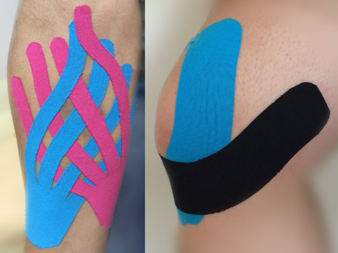 Kinesiotaping a ciąża Kinesiotaping a ciąża